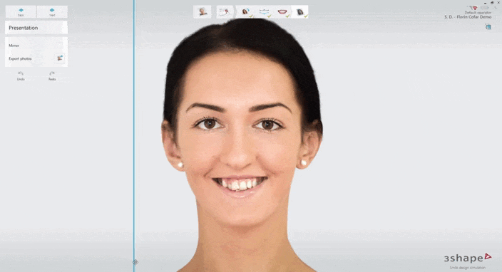 TRIOS Smile Design 