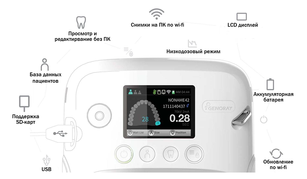 Портативный рентген PORT-X IV размеры и вес
