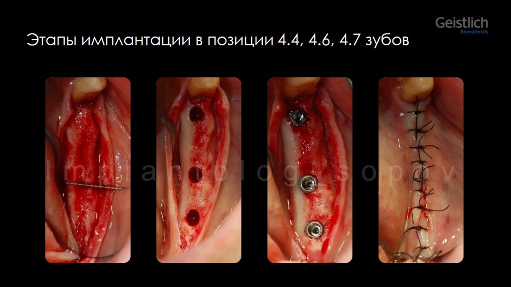 Анонс курса Сопова по Geistlich