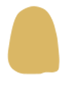 Виниры схема