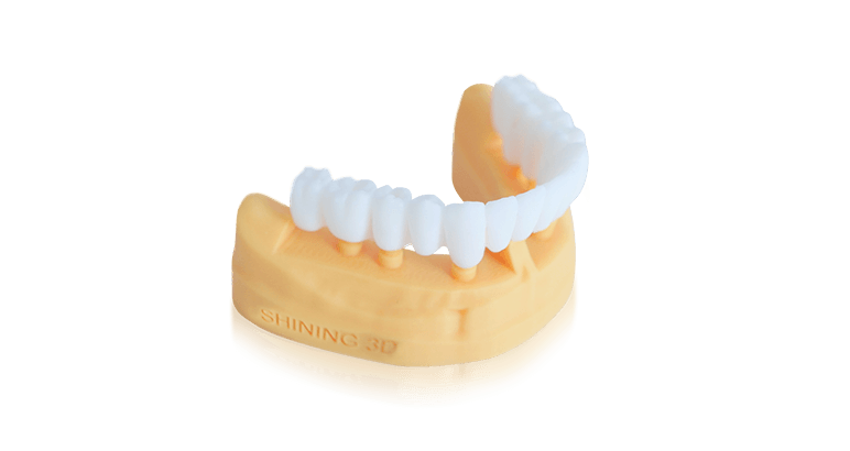 Implant-Try-on