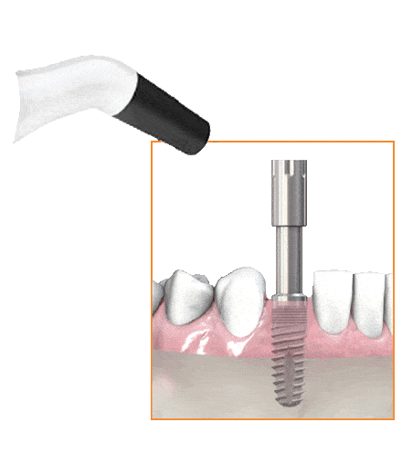 tooth transformer
