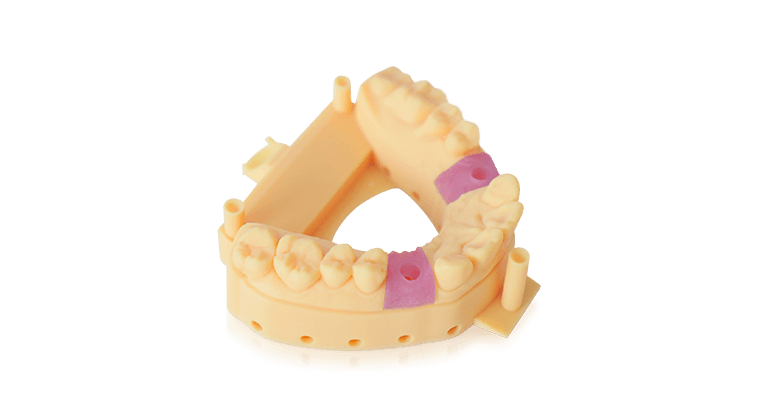 Gingiva-Mask