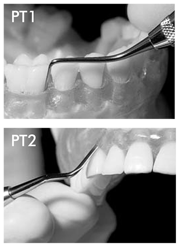 ериотомs Periotome posterior. Hu-Friedy, PT1 и PT2