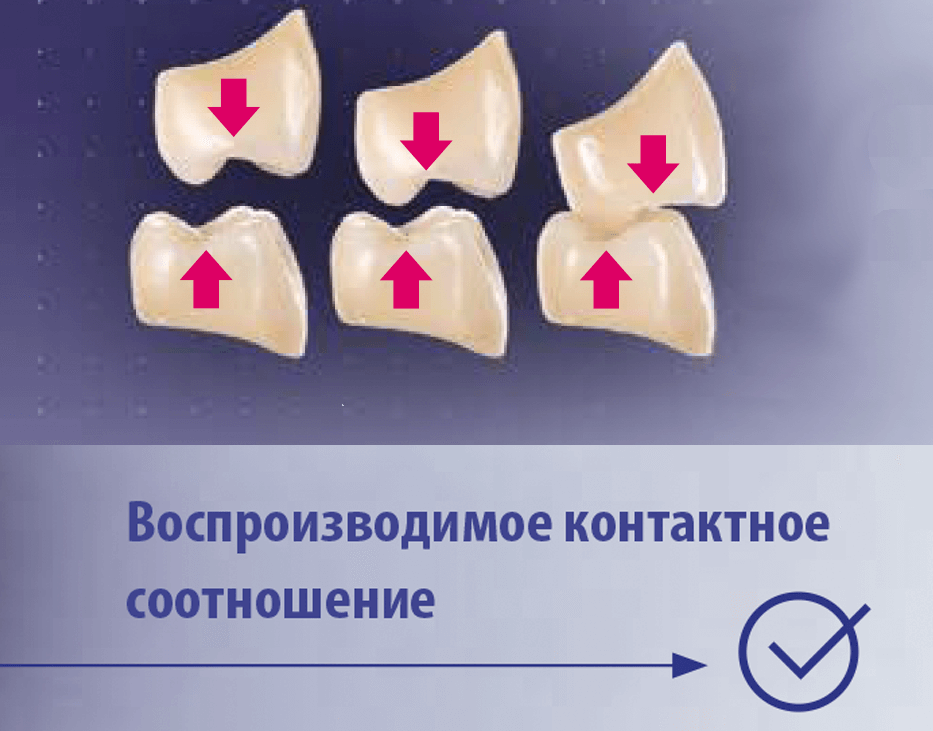 Воспроизводимое контактное соотношение зубов VITA